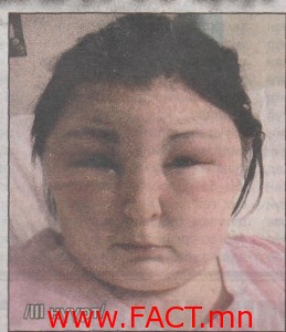 aimaar914286410201405091244