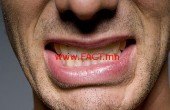 getty_rf_photo_of_man_clenching_teeth