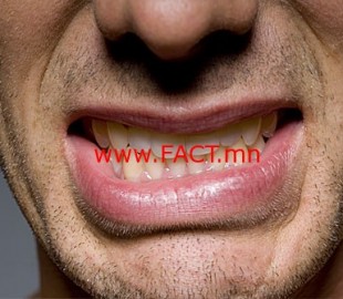 getty_rf_photo_of_man_clenching_teeth