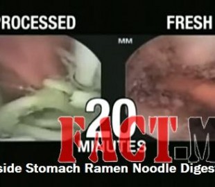 Inside-Stomach-Ramen-Noodle-Digestion