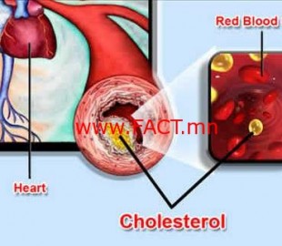 cholesterol_heart_disease