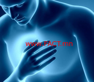 chest-pain11-750x326