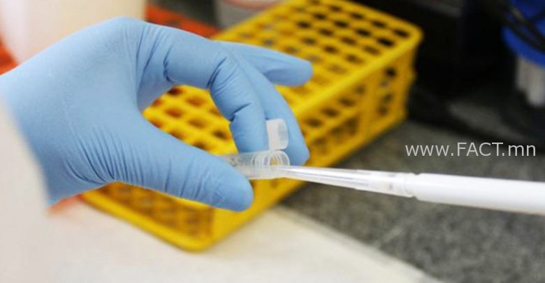 104209a4d4a47554eba9de469af9b50dc577fd9f-780x405