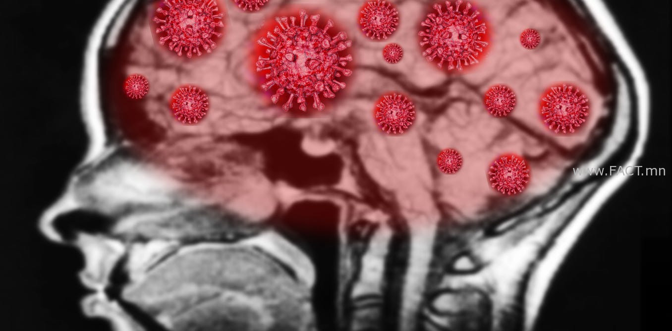 file-20200730-13-i8elh1