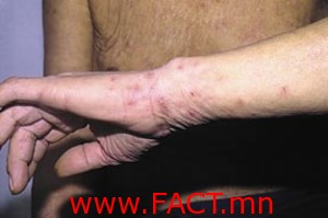 5e23a3528282cf3doriginal