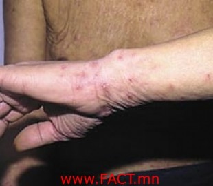 5e23a3528282cf3doriginal