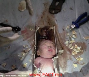 mat_smyla_novorozhdennogo_rebenka_v_kanalizaciju_13_foto_10