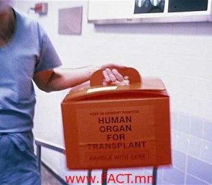 organ-transplant_2027887b