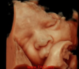 f38e5ab870e310c7great