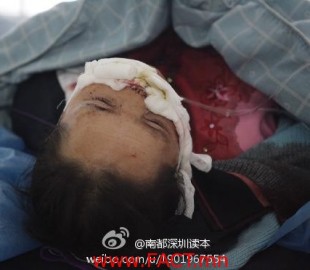 victim-shenzhen-knife-attack