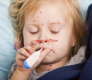 159361-06042015-1428286866-1441030725-ulaanburhan