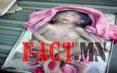 3cd0df4a52dfd071269be1413152a72a