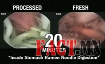 Inside-Stomach-Ramen-Noodle-Digestion