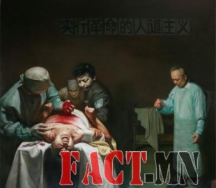 OrganHarvesting-580x584-450x453