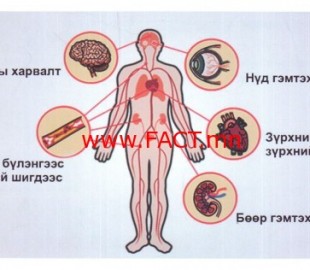 1464575629574ba68d81632