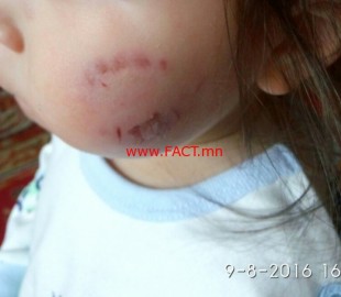 c11675552a2ce10dc1113aba9f6856c1