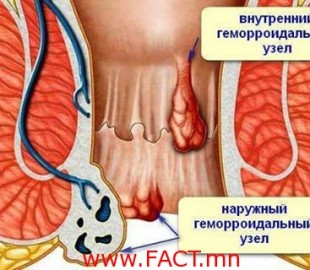 15590452_1755946118049841_258052018222396598_n