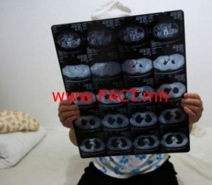 527-14863498959E789866-2EC3-417E-B429-54C7BACCCDF8_cx0_cy3_cw0_w987_r1_s_r1