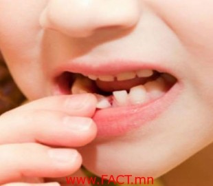 large_S7WfvMO3Ho2MScq