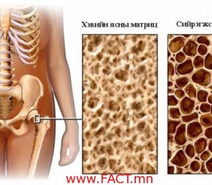 14995745435961b10fa90ee