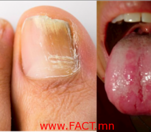 13-1-696x385-600x332