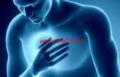 chest-pain11-750x326