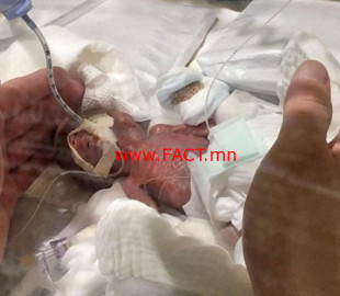 712-15512437765c76188d9fad3