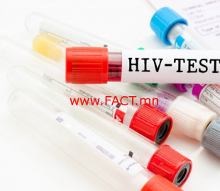 15596406215cf63a2d484a8