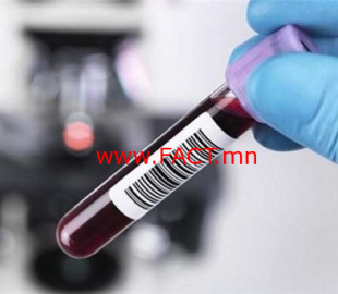 15598373185cf93a8695e70