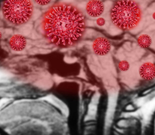 file-20200730-13-i8elh1