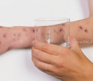 5de2767ff395637b4ac20e58fe2a4c4b_x3